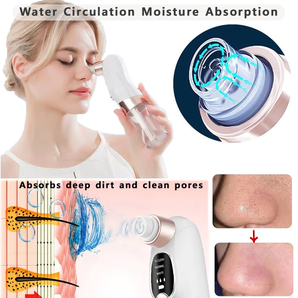 Pore Vacuum Cleaner Blackhead Remover